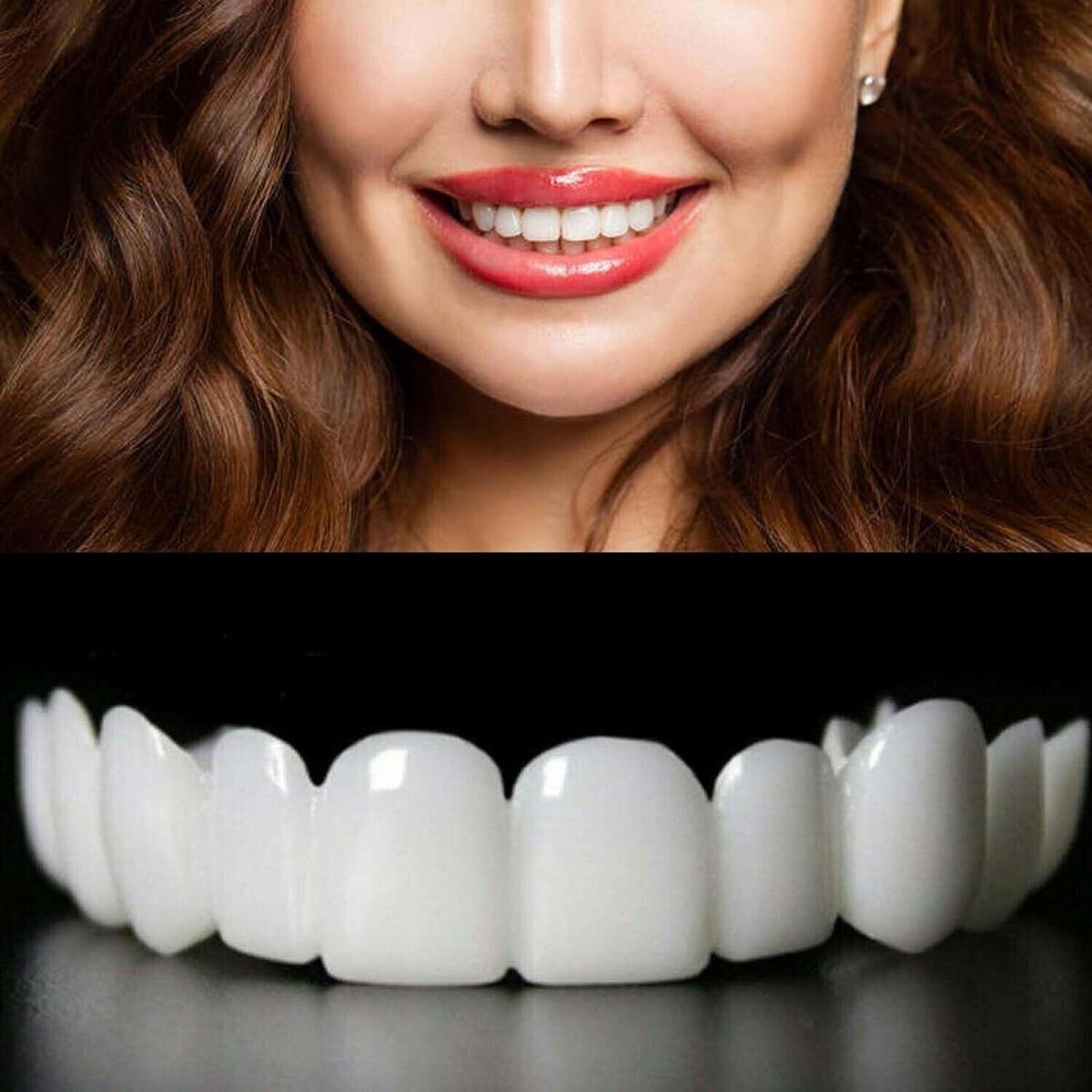 CARILLAS DENTALES importadas SnapS